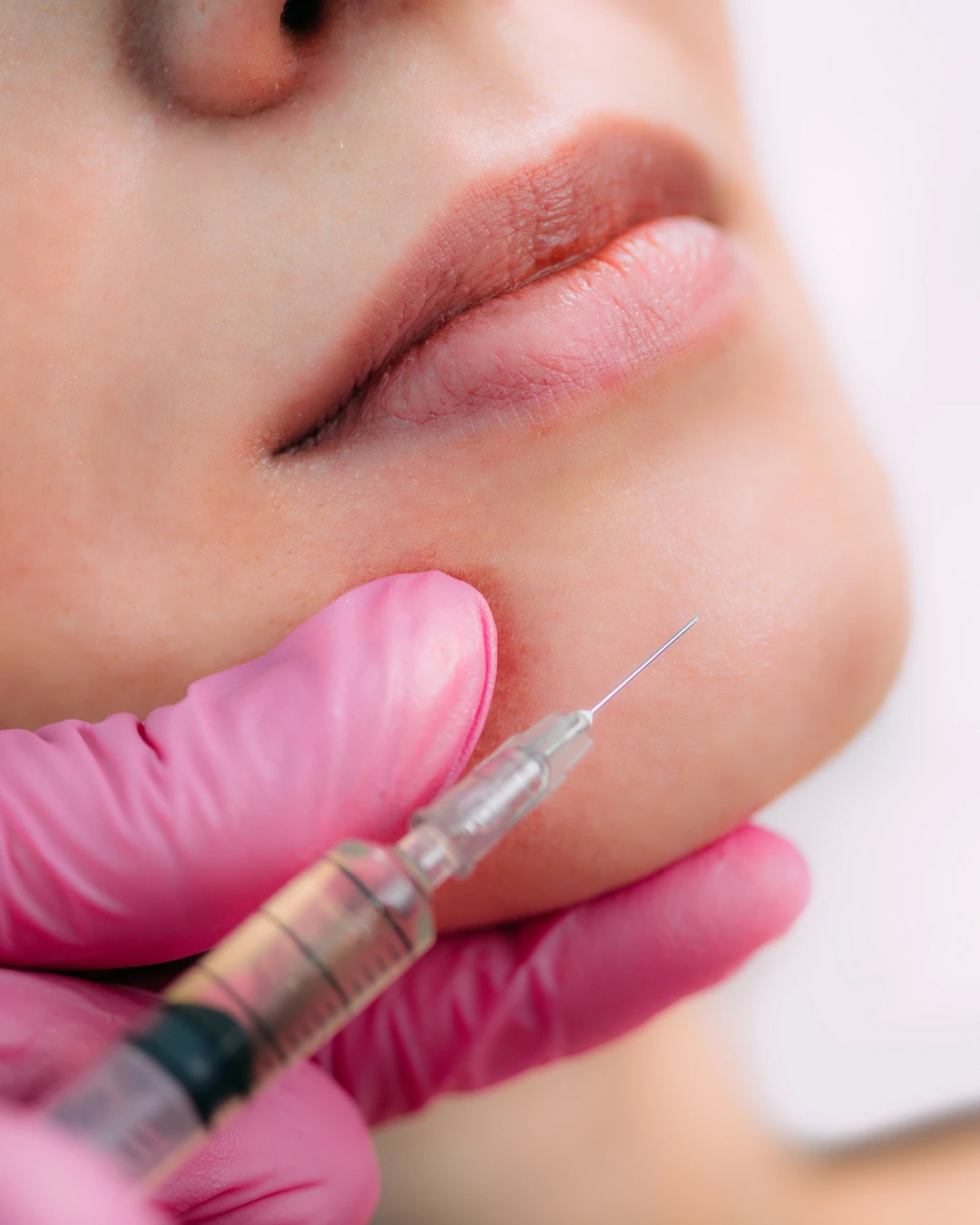 Non Surgical Chin Filler Stock