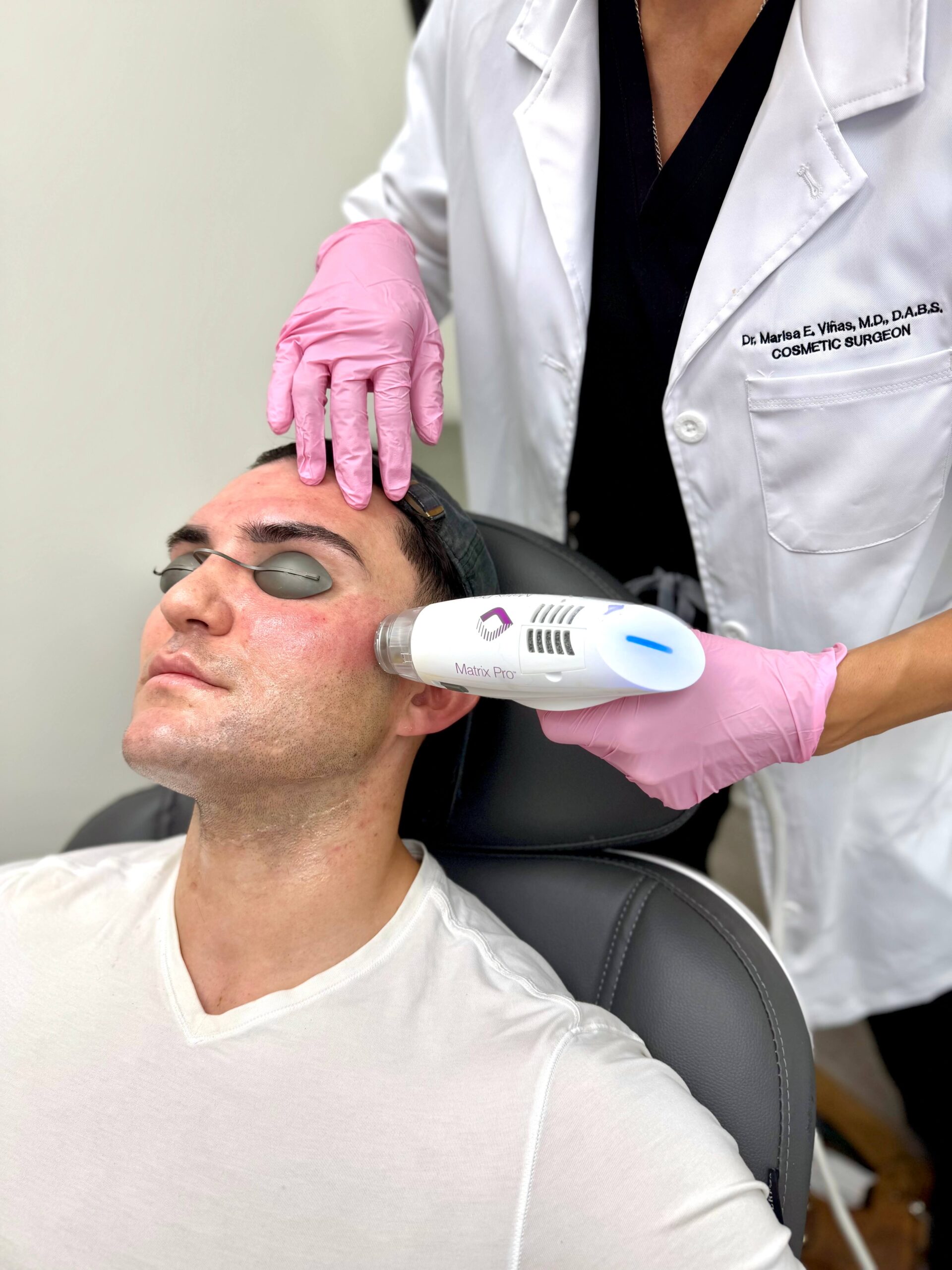 Laser Skin Resurfacing (Erbium)